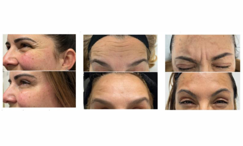 Harmonização Orofacial Equilíbrio entre Saúde e Estética Harmonização Orofacial Equilíbrio entre Saúde e Estética